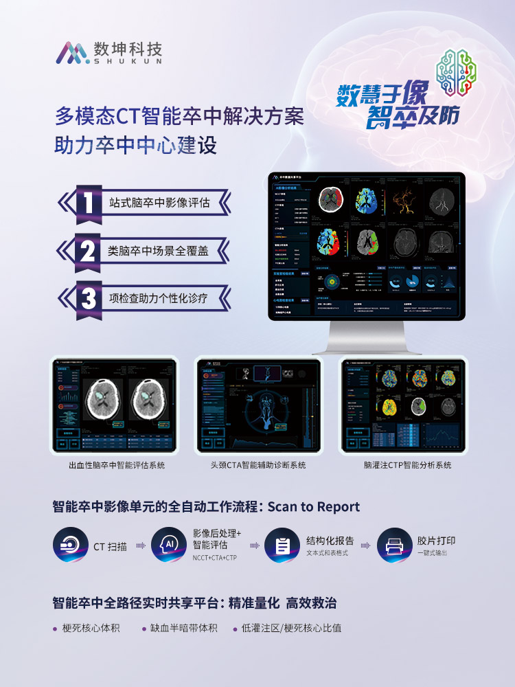 多模态CT智能卒中解决方案